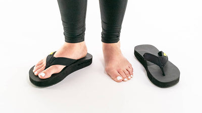 Why Do Bunions Hurt So Badly?