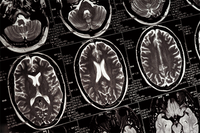 The Effects of GABA on the Brain