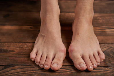 Conditions Mistaken For Plantar Fasciitis