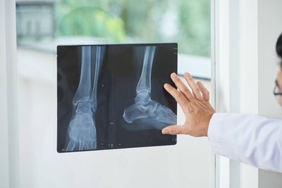 Most Common Orthopedic Injuries