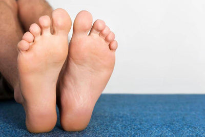 How to Treat Plantar Fasciitis at Home