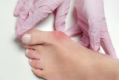 Get Rid of Gout Pain With Tart Cherry Extract