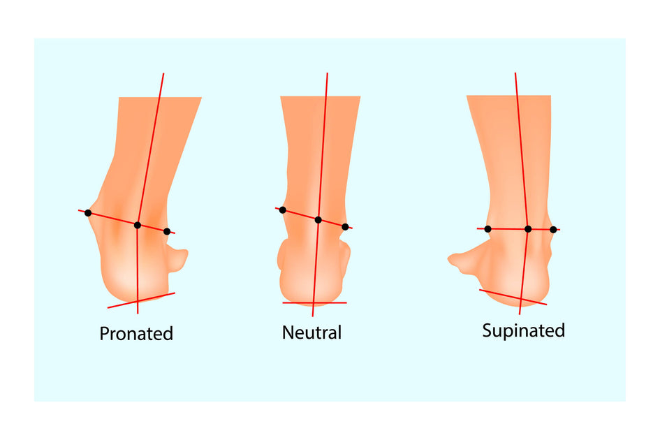 Everything You Need to Know About Pronation – The Healing Sole