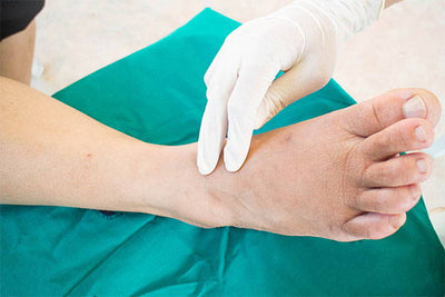 5 Natural Ways To Relieve Diabetic Neuropathy